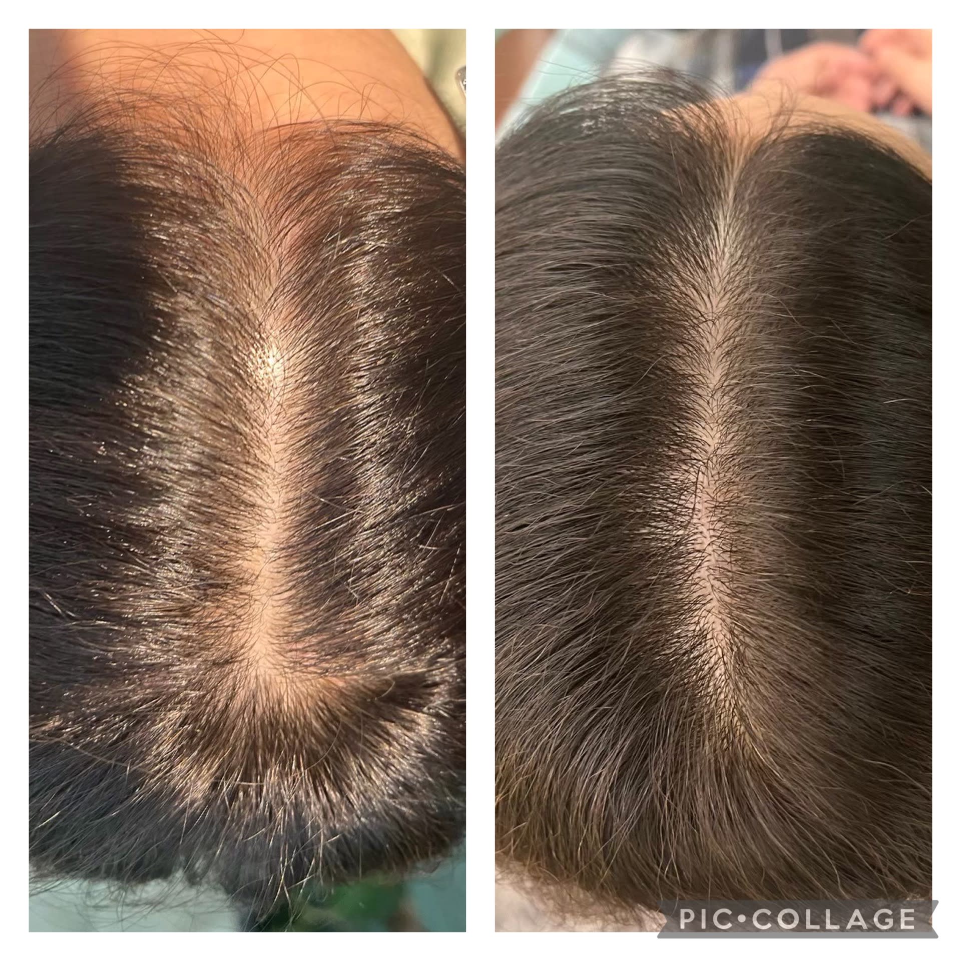 HEAD CONNECT E_2